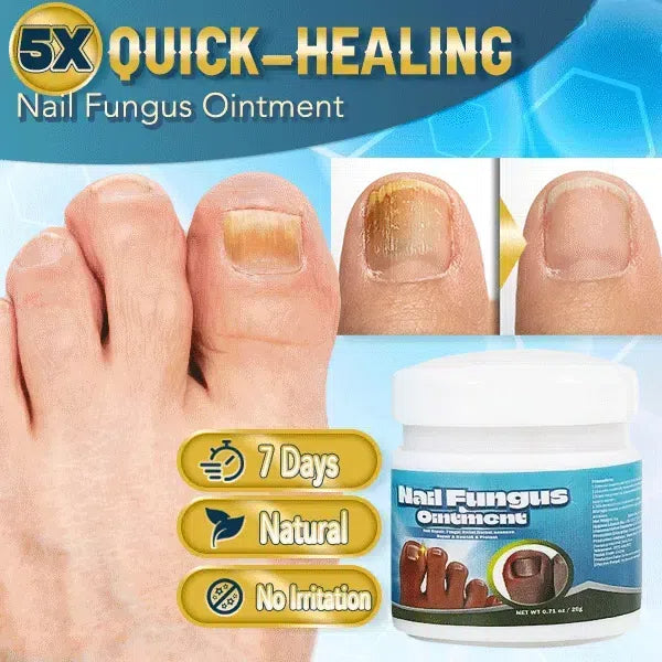 LOVILDS™ 5X Fast-Acting Nail Fungus Ointment